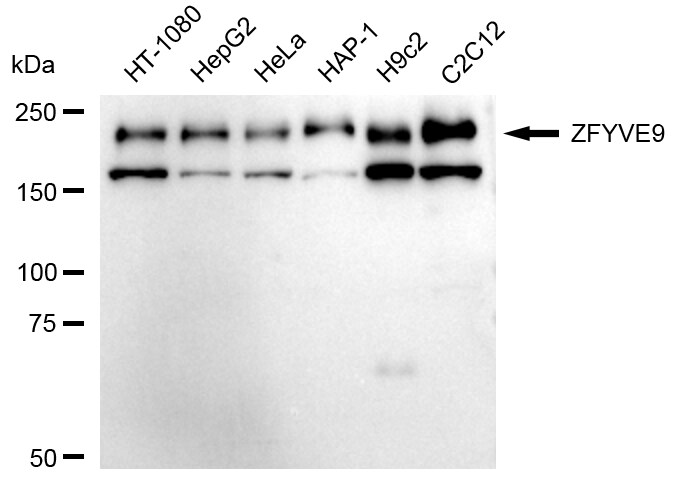 ZFYVE9 Antibody (24GB1885)