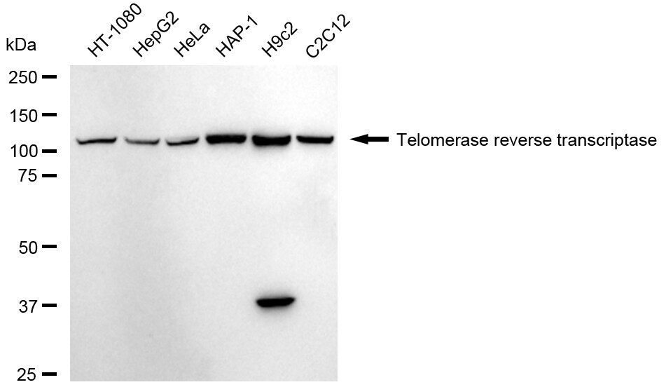 TERT Antibody (24GB1945)