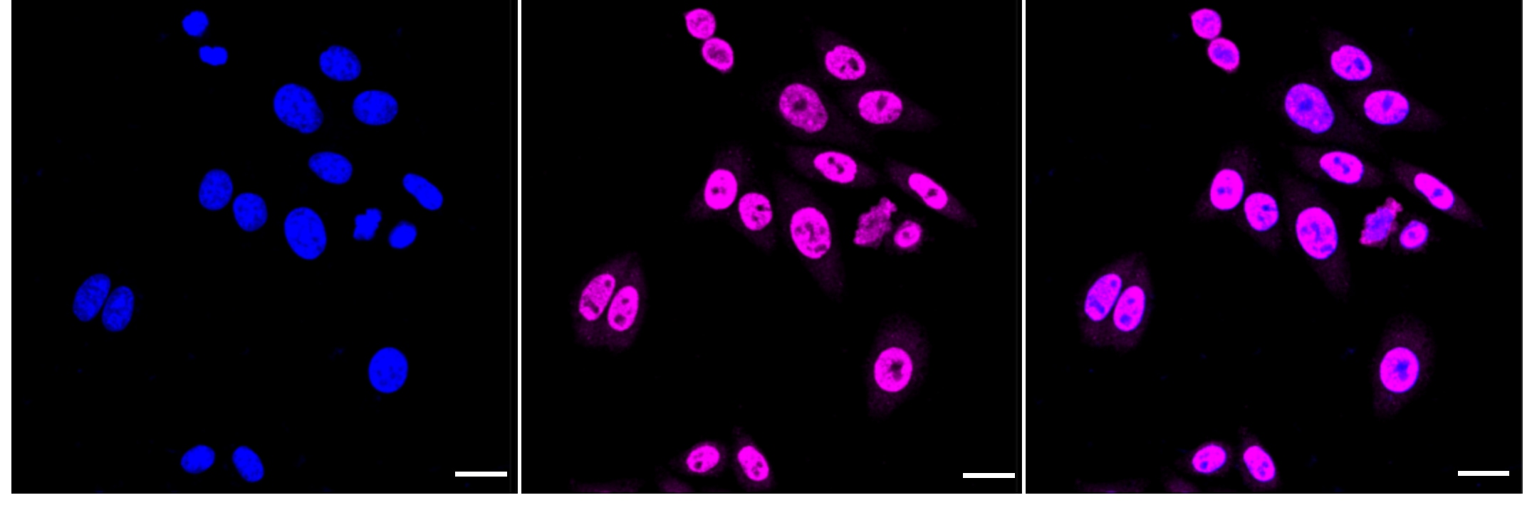 TRAM2 Antibody (24GB1960)