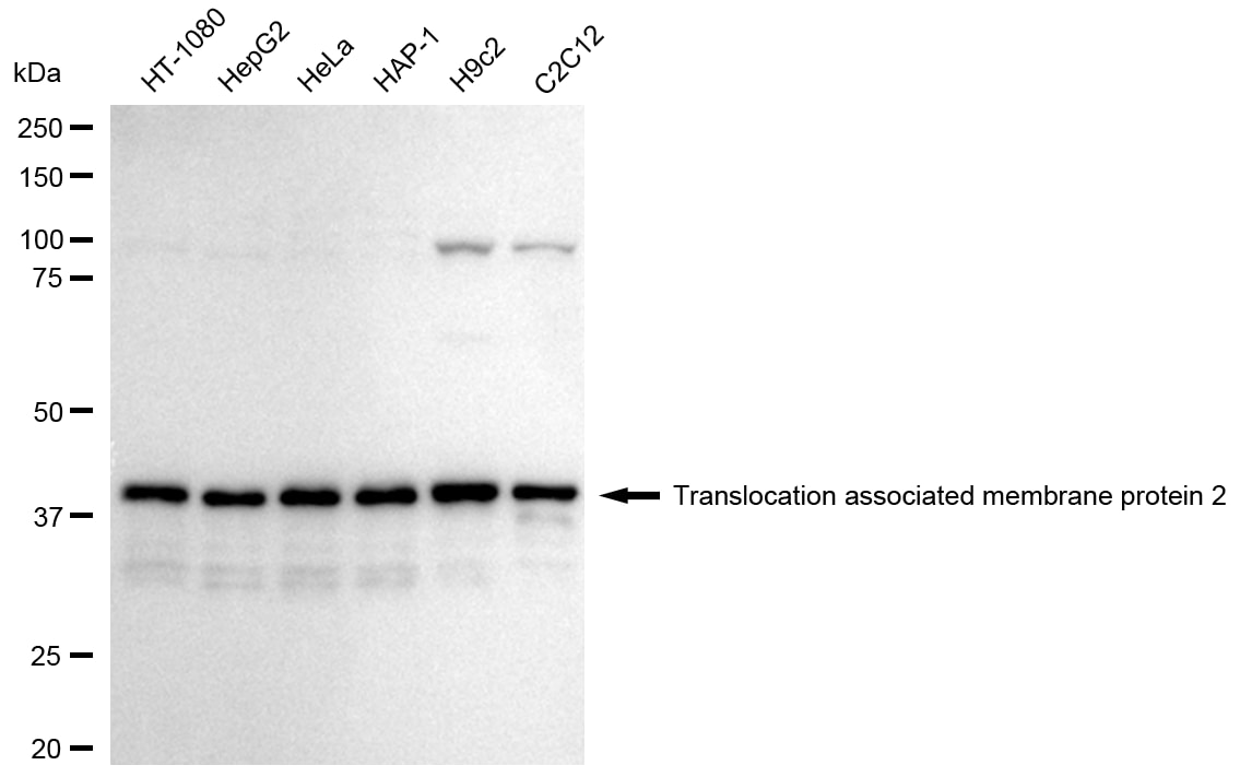 TRAM2 Antibody (24GB1960)