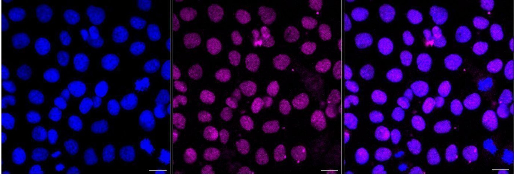 Synaptophysin Antibody (24GB1970)