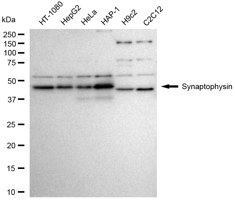 Synaptophysin Antibody (24GB1970)