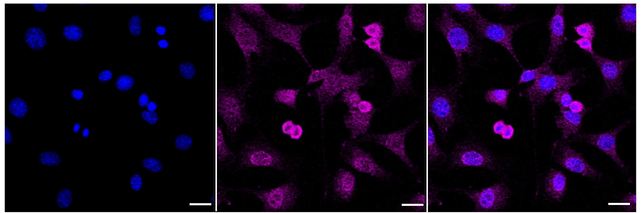 DPYSL4 Antibody (23GB1510)