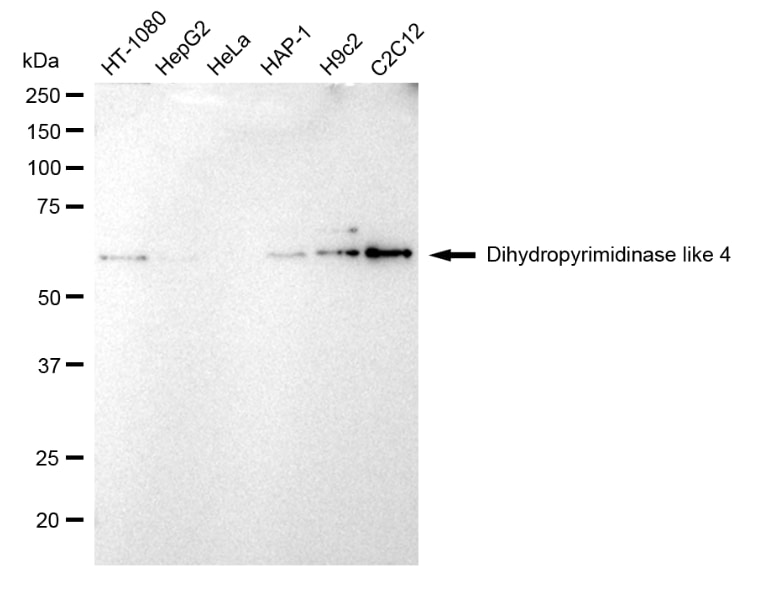 DPYSL4 Antibody (23GB1510)