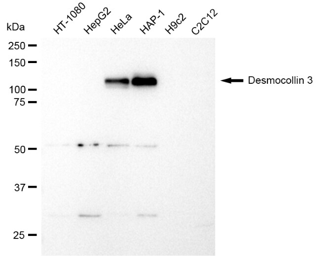 Desmocollin-3 Antibody (23GB1200)