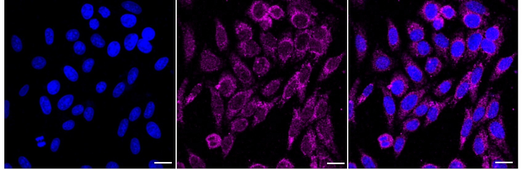 WIPI1 Antibody (24GB2285)