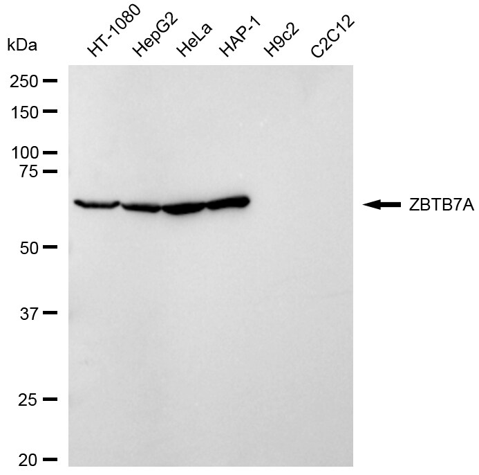 ZBTB7A/Pokemon Antibody (24GB2395)