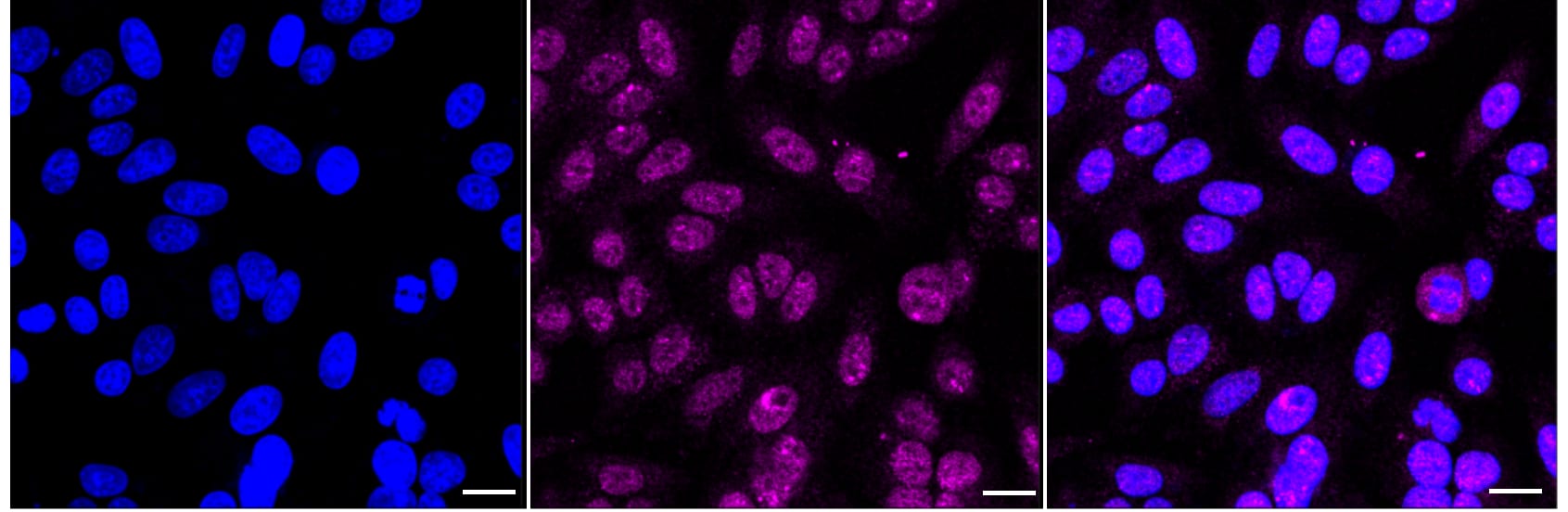 Ubiquitin-activating Enzyme/UBE1 Antibody (24GB2435)