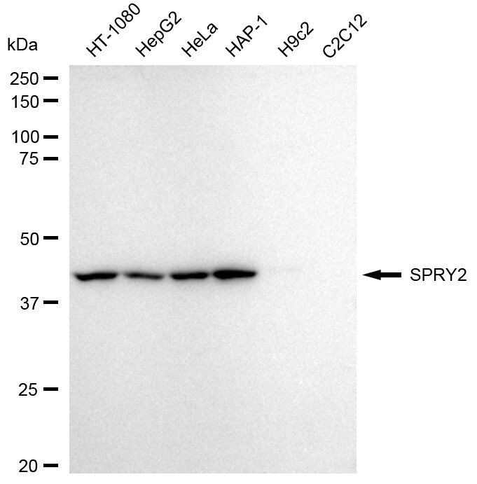 SPRY2 Antibody (24GB2525)