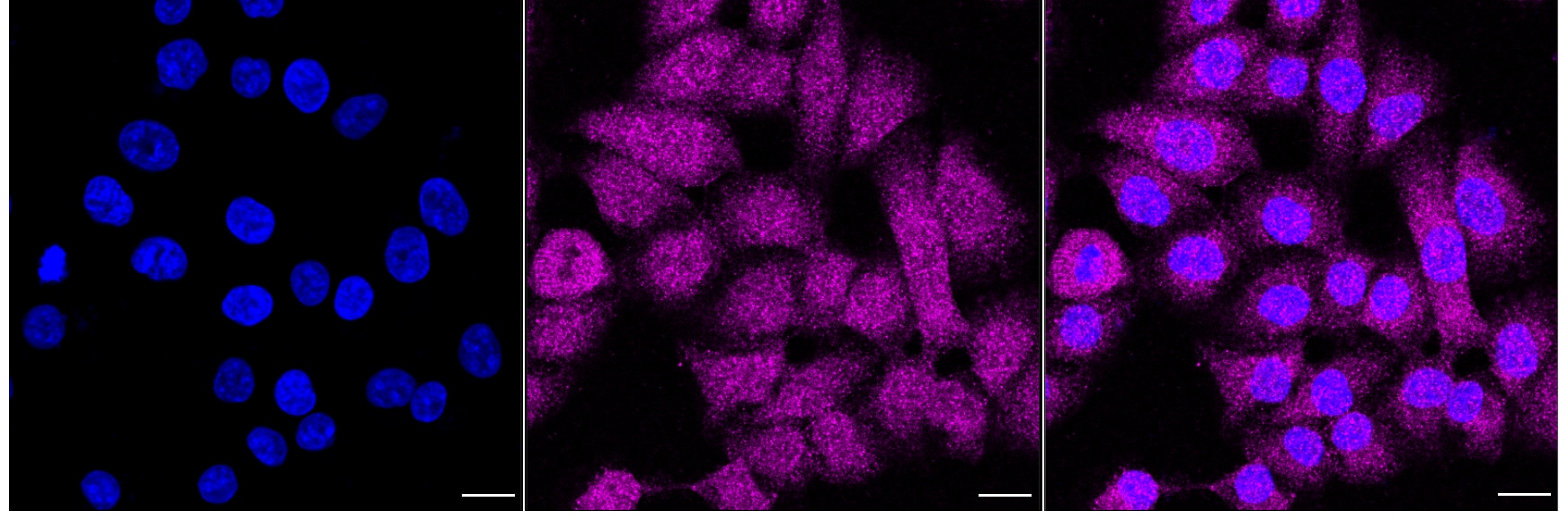 UBE2N/Ubc13 Antibody (24GB2555)
