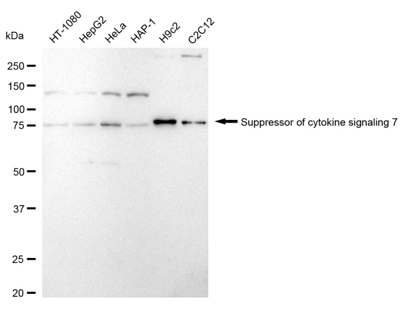 SOCS-7/Nck/NAP4 Antibody (24GB1820)