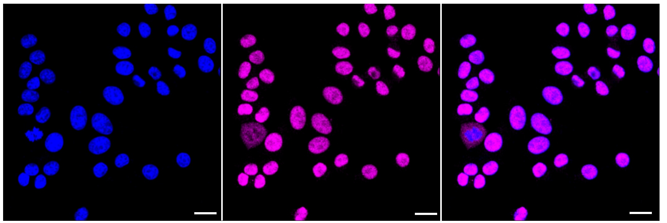 FTO Antibody (23GB1805)