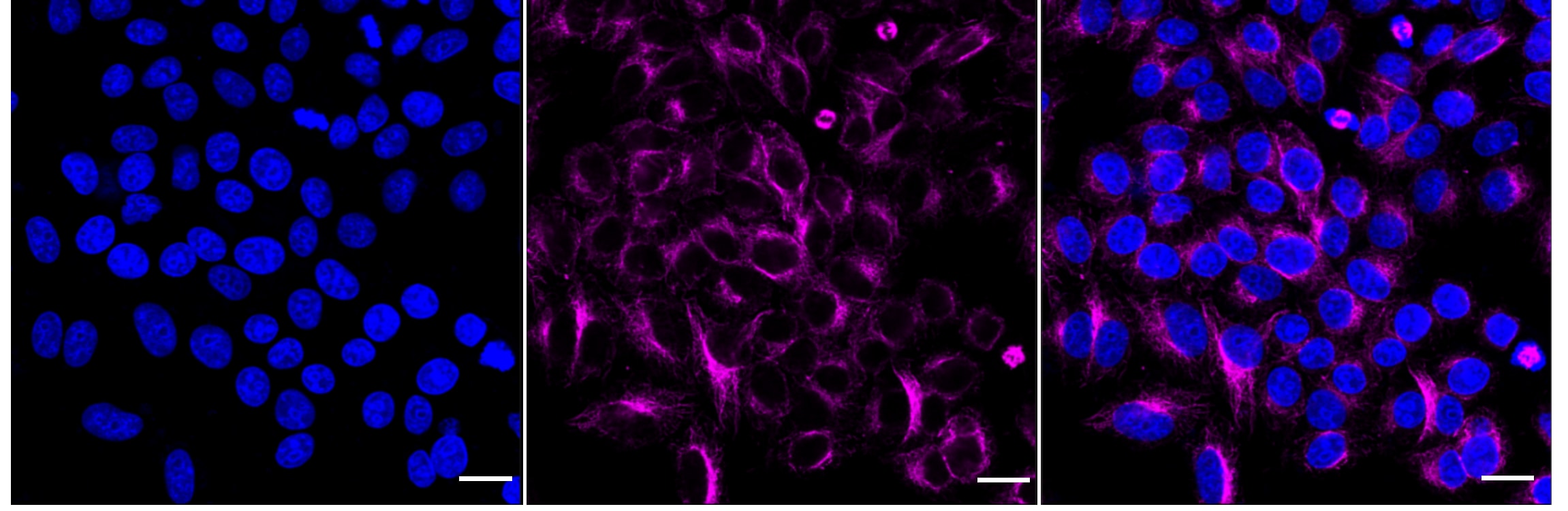 TUBA1B/TUBA4A Antibody (24GB2020)