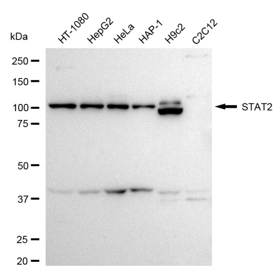STAT2 Antibody (24GB2095)