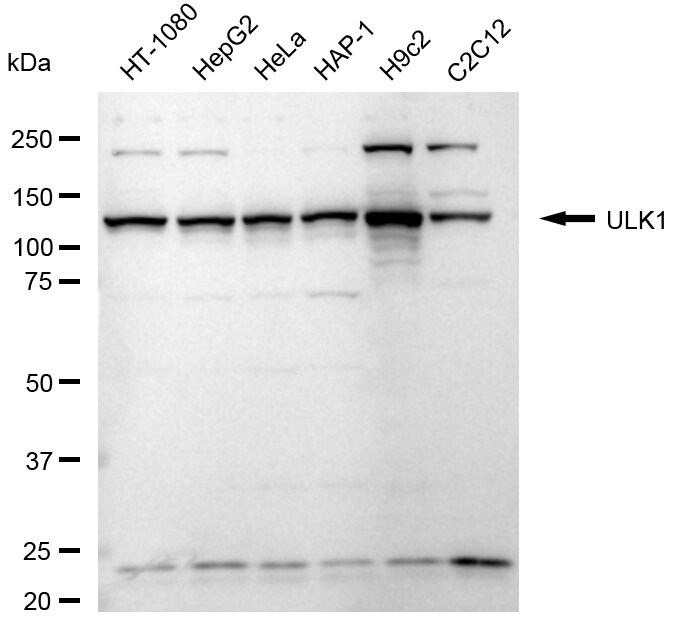 ULK1 Antibody (24GB2195)
