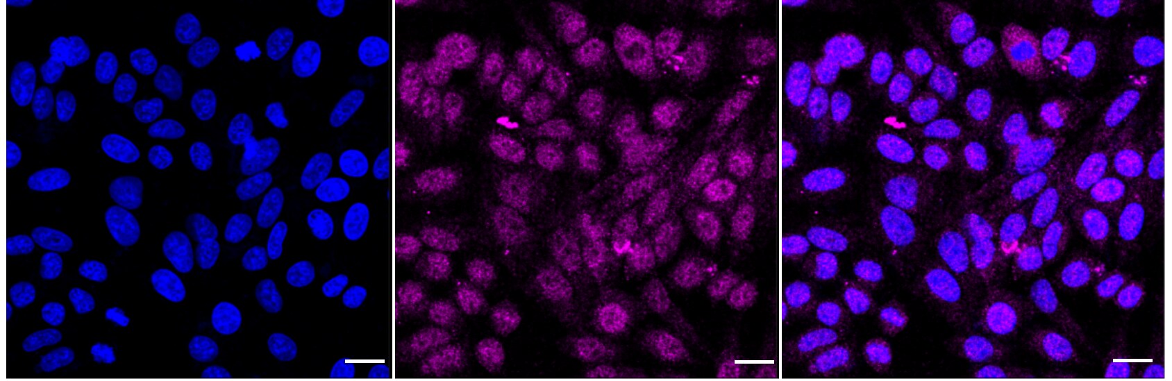 TRPM8 Antibody (24GB2225)