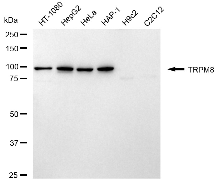 TRPM8 Antibody (24GB2225)