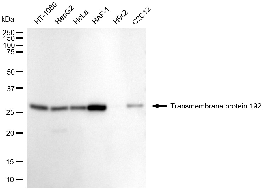 TMEM192 Antibody (24GB2305)