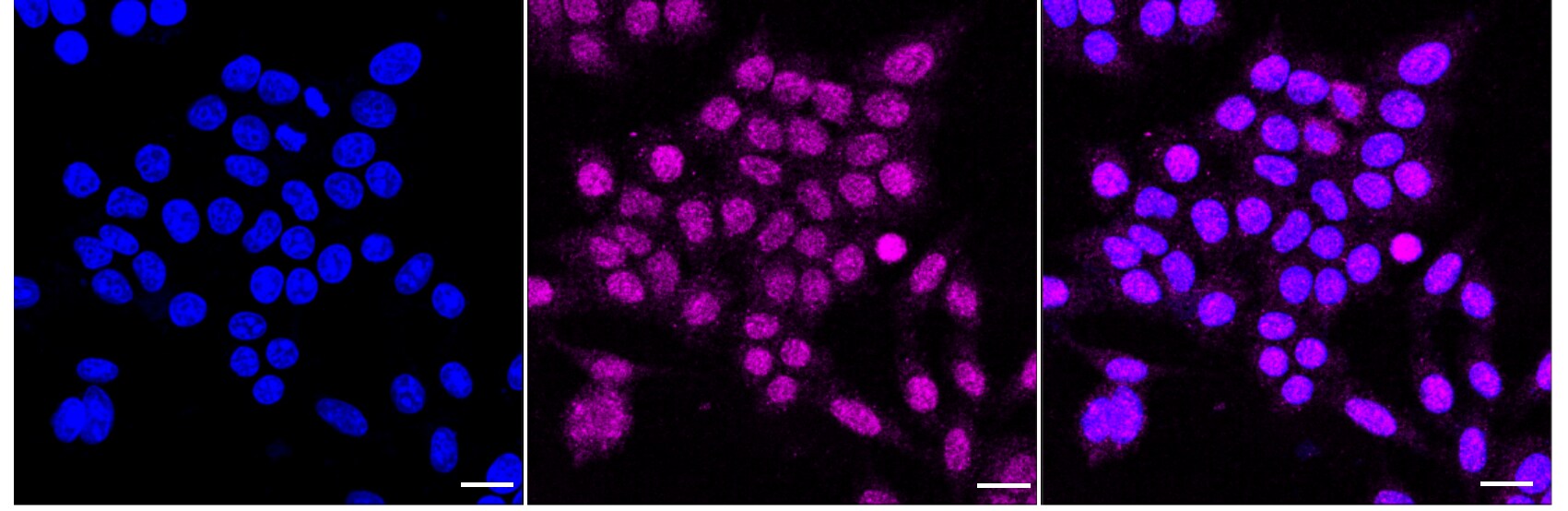 Thyroid Peroxidase Antibody (24GB2625)