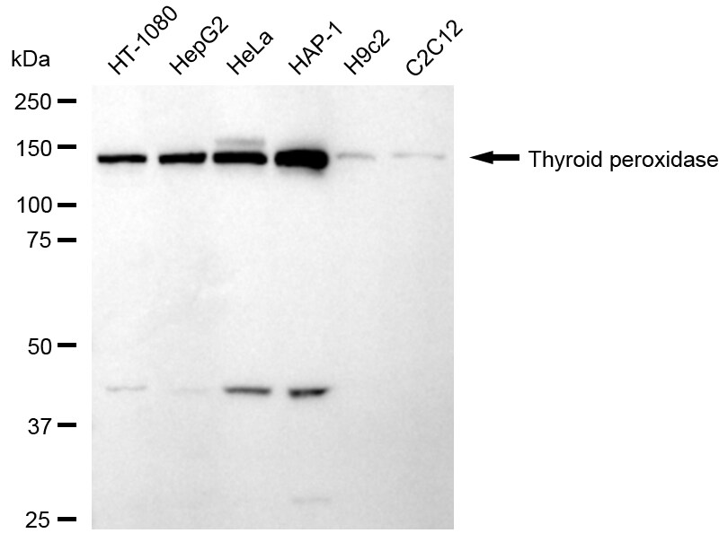 Thyroid Peroxidase Antibody (24GB2625)