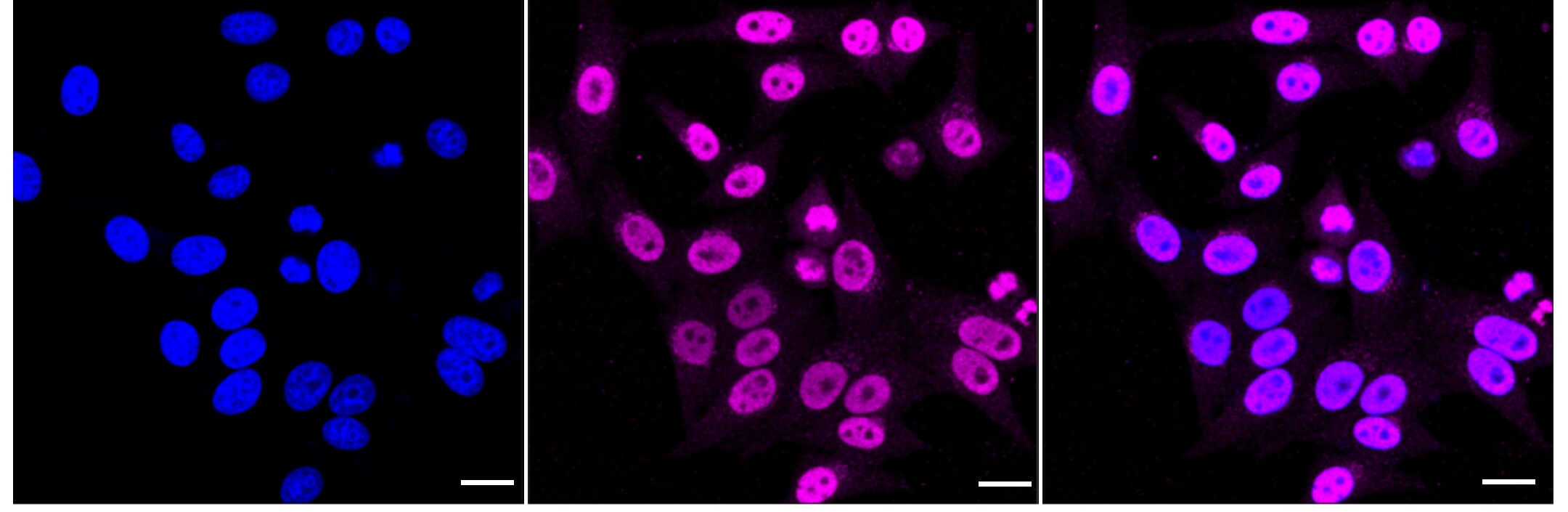 WAPL Antibody (24GB2675)