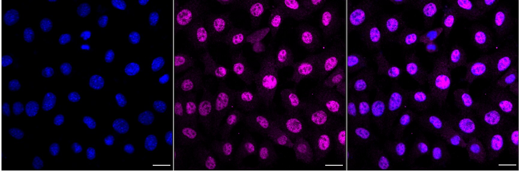 p53 DINP1 Antibody (24GB2470)