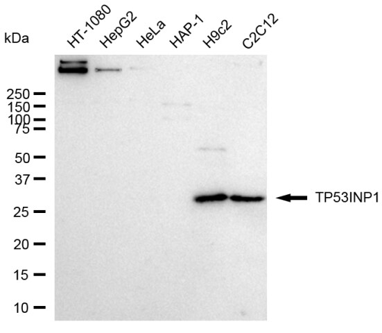 p53 DINP1 Antibody (24GB2470)