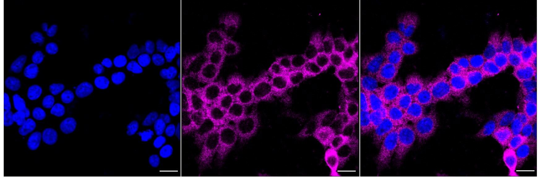 KIF1B Antibody (24GB2890)