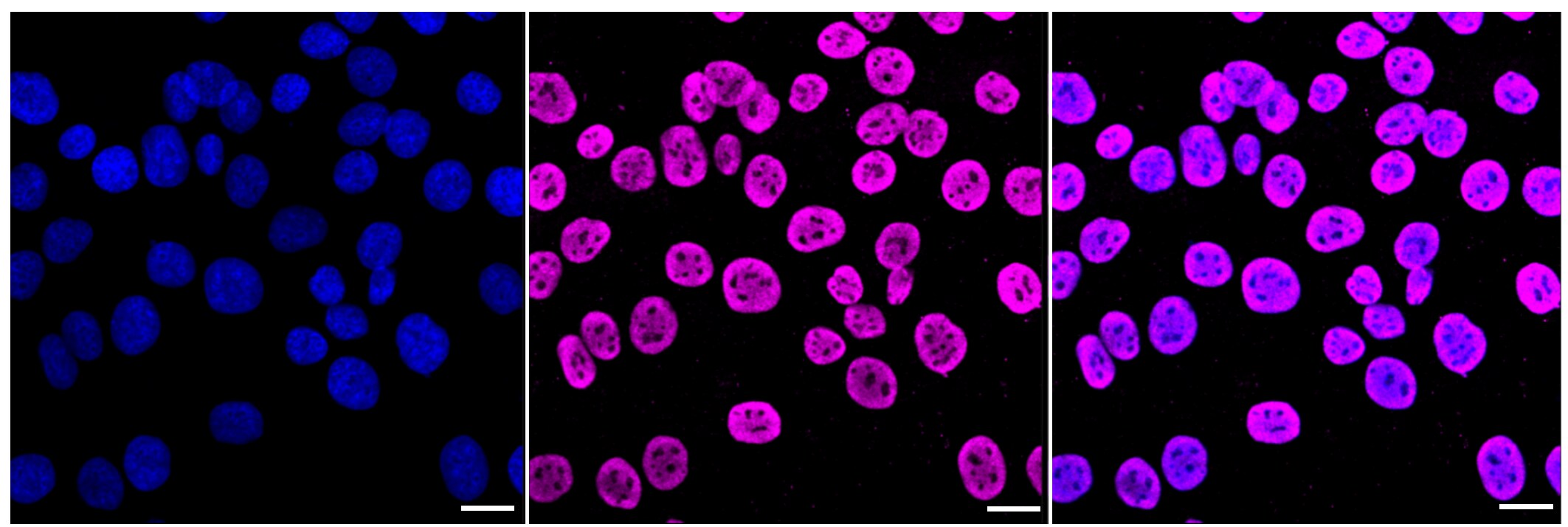 EWSR1 Antibody (23GB1590)