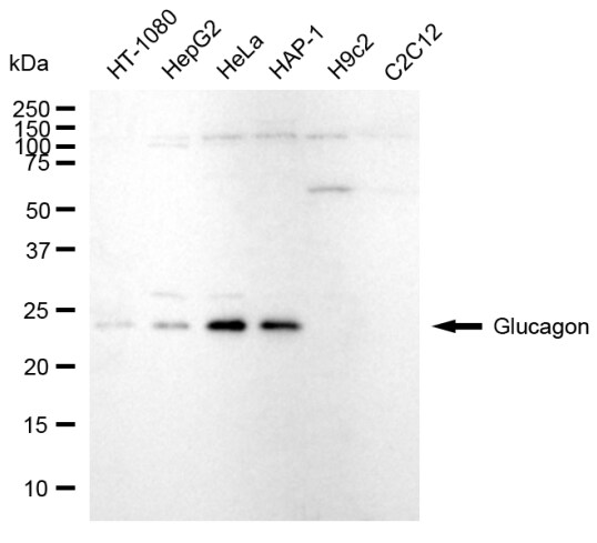 GLP2 Antibody (24GB2965)