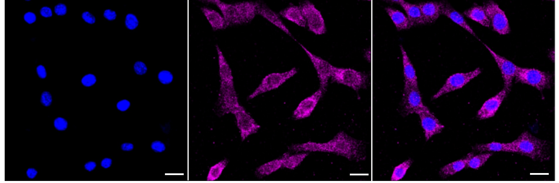 Glycerol Kinase Antibody (24GB3000)