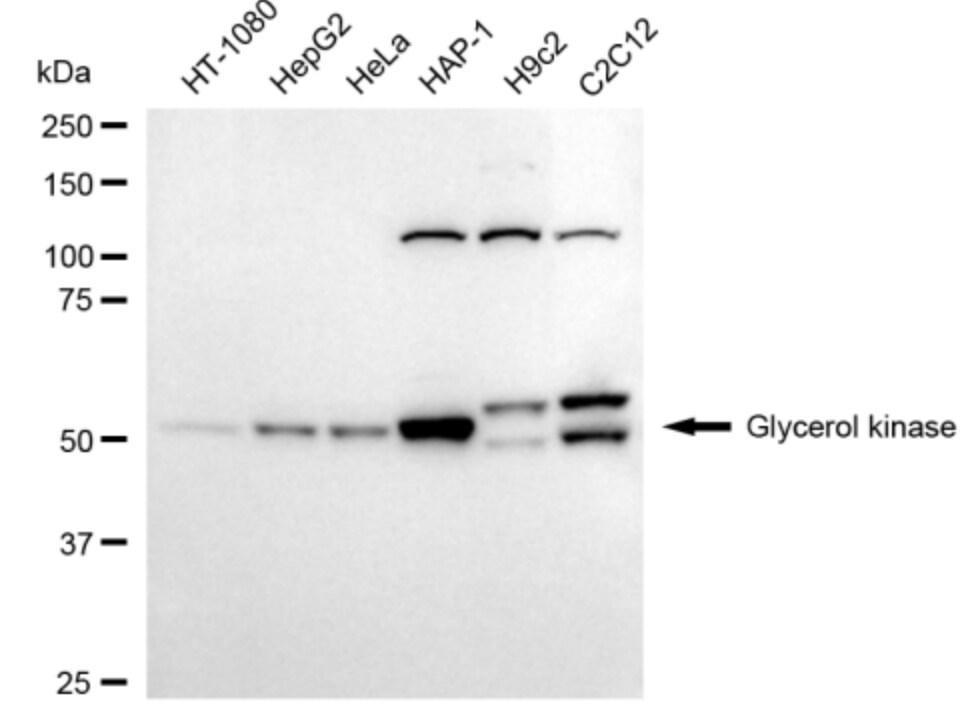 Glycerol Kinase Antibody (24GB3000)