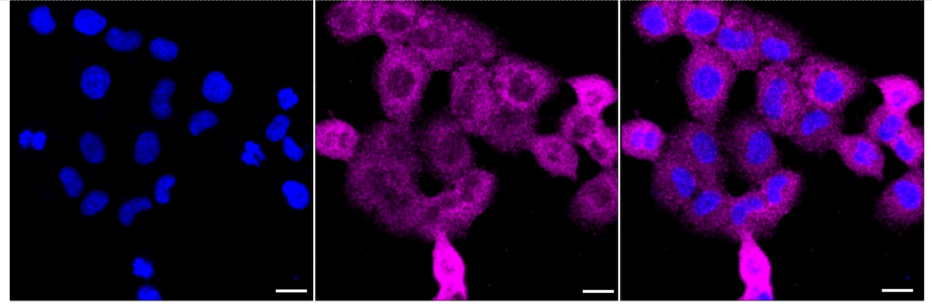CARS Antibody (24GB3015)
