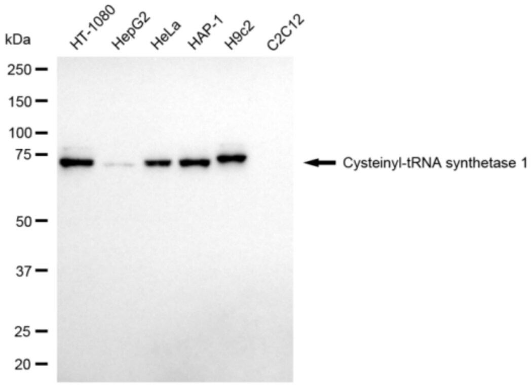 CARS Antibody (24GB3015)