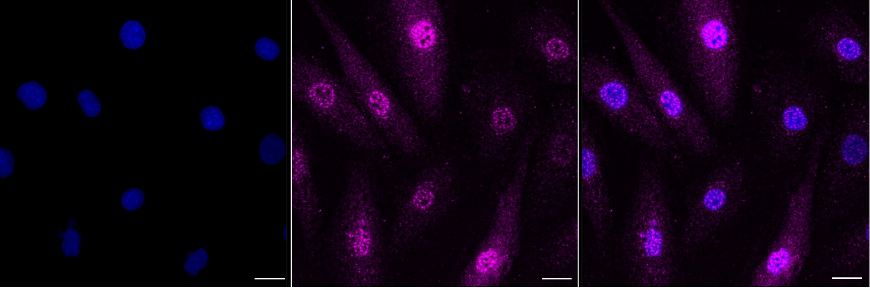 Cystatin B/Stefin B Antibody (24GB3050)