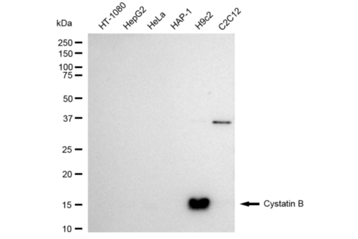 Cystatin B/Stefin B Antibody (24GB3050)