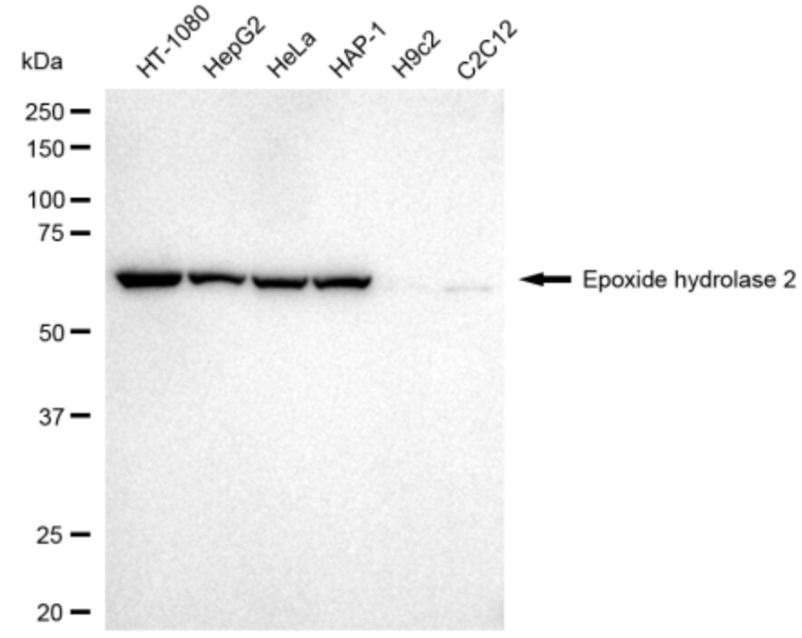 EPHX2 Antibody (24GB3070)