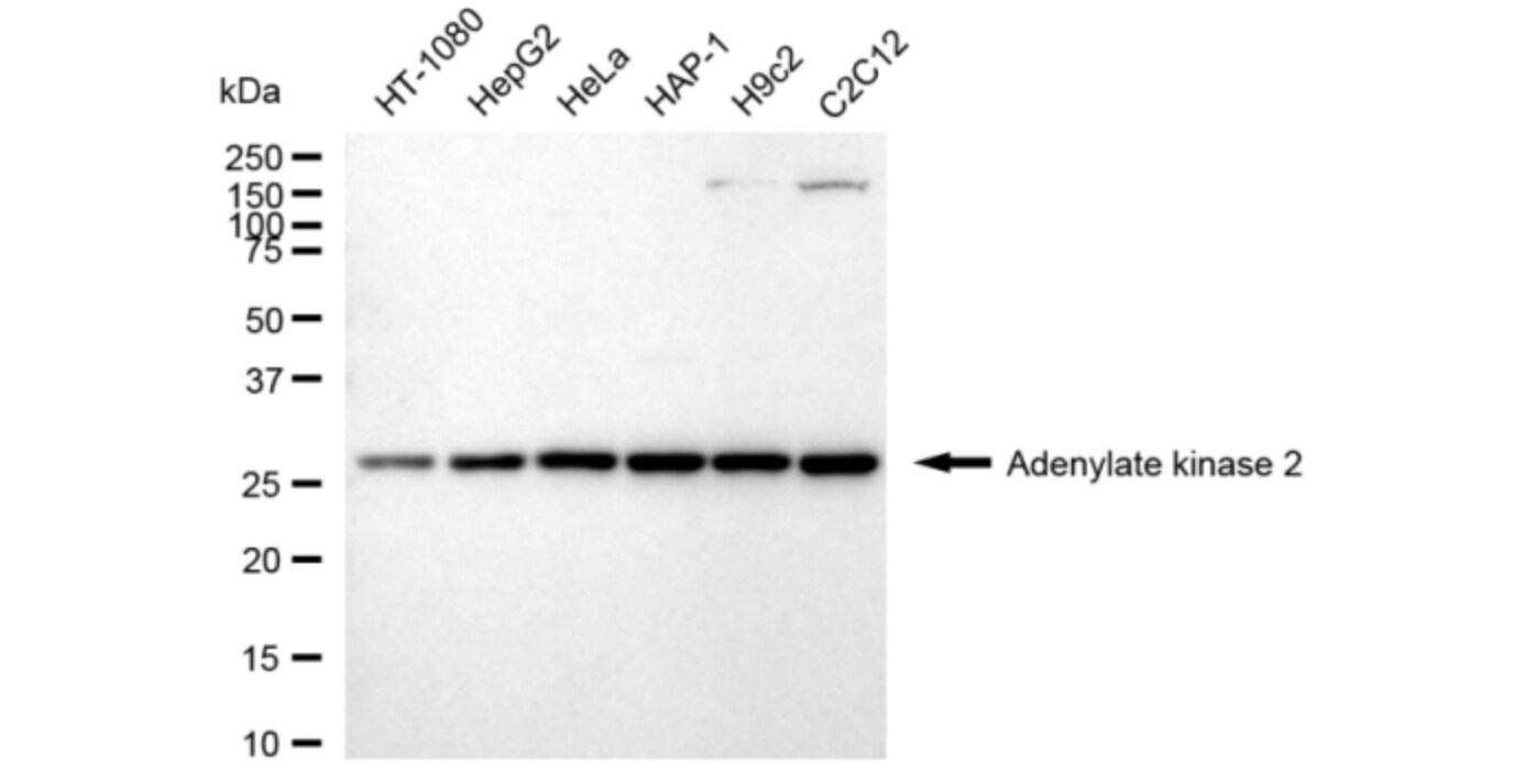 AK2 Antibody (24GB3075)