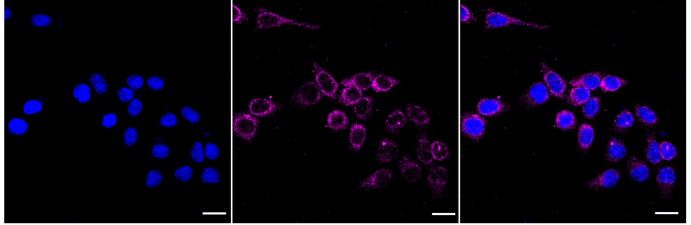 ACADM Antibody (24GB3160)