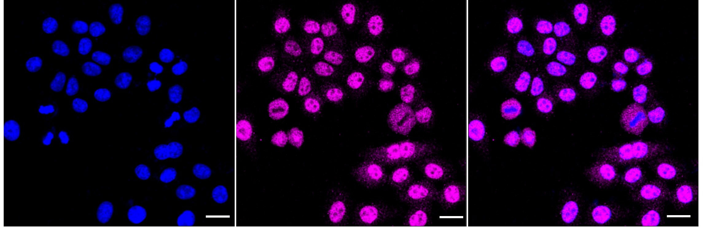 Elk-1 Antibody (24GB3180)