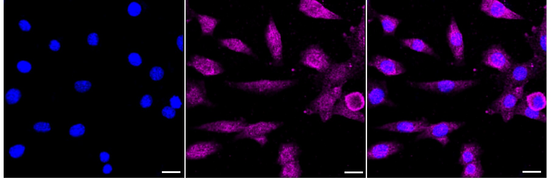 GAS2 Antibody (24GB3195)