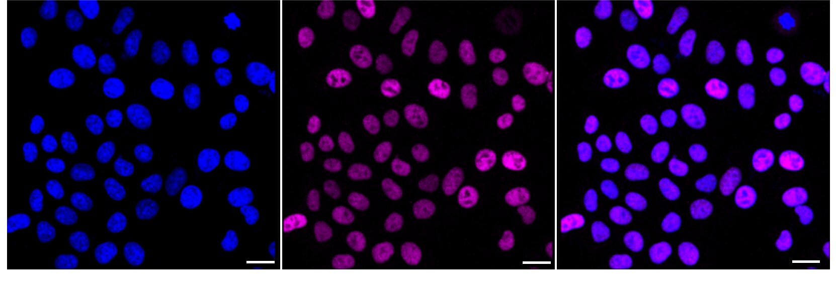 NEDD4L Antibody (24GB3280)