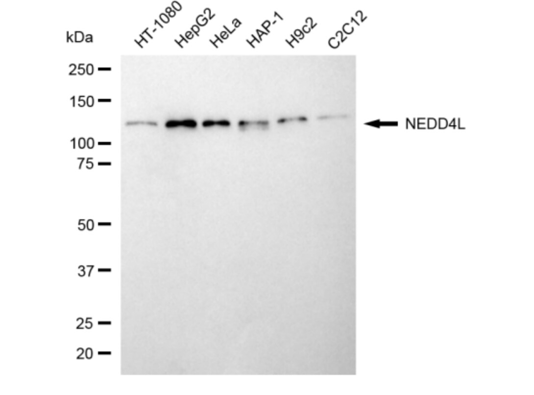 NEDD4L Antibody (24GB3280)