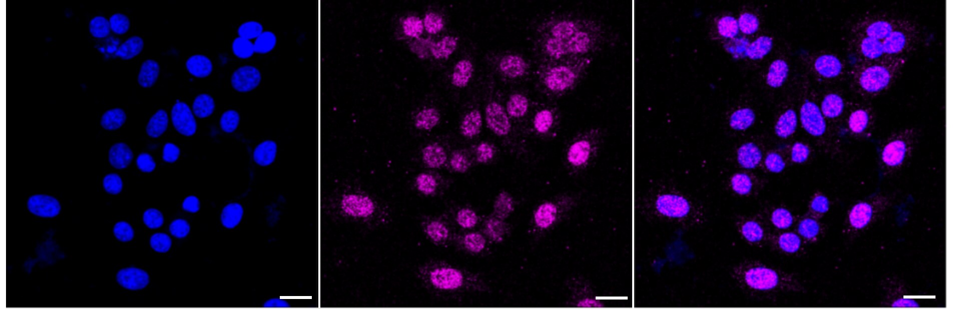 FOXO3 Antibody (24GB3325)