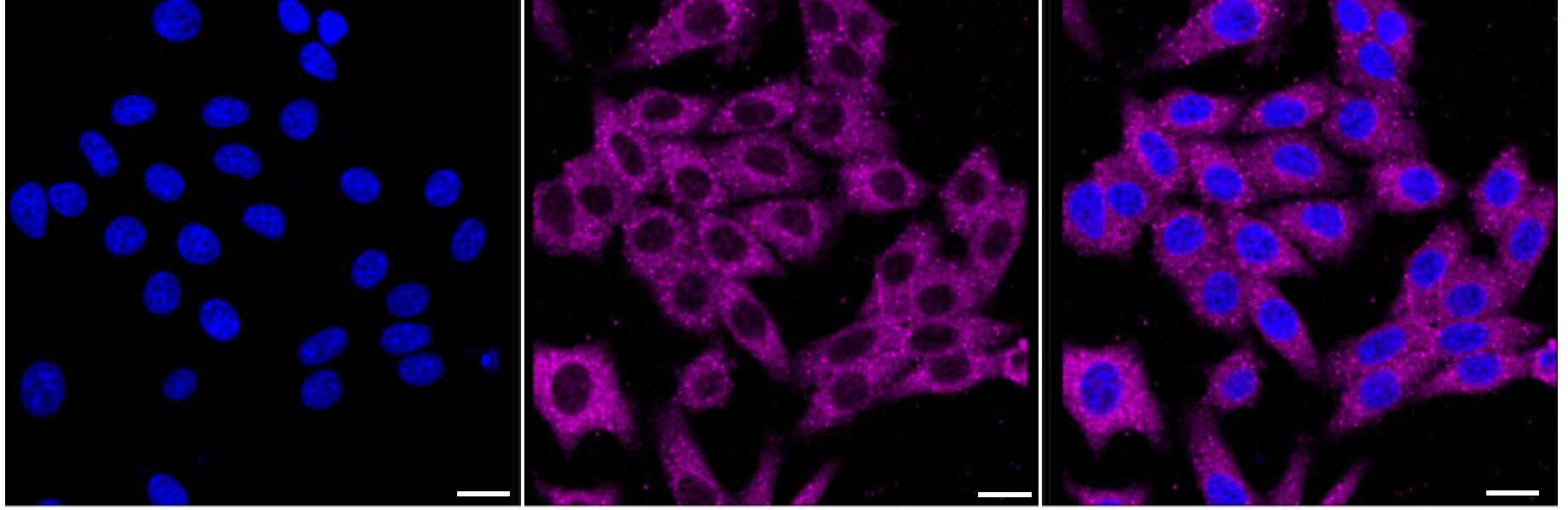 A-RAF Antibody (24GB3345)
