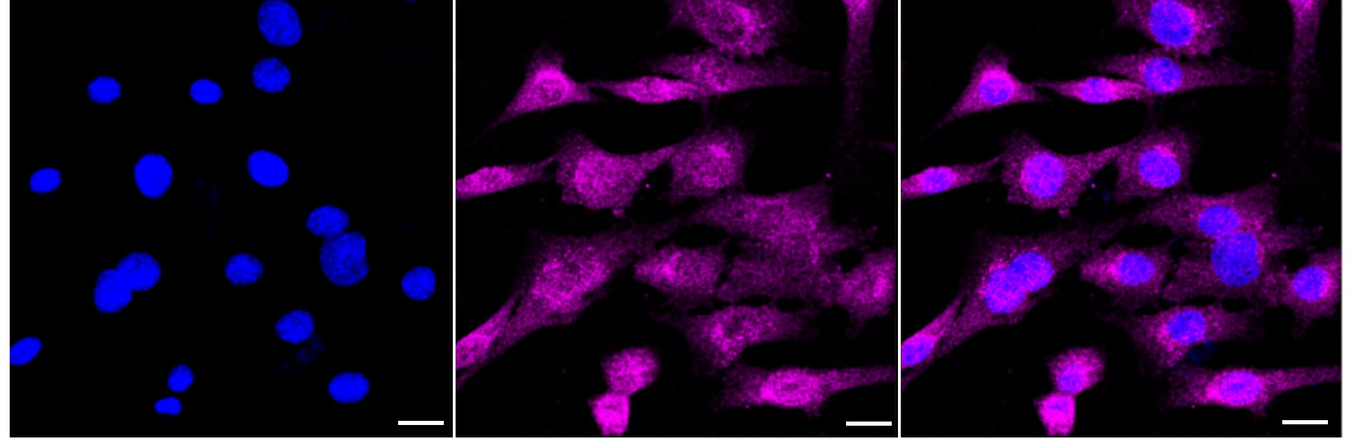 CaM Kinase II delta Antibody (24GB3390)