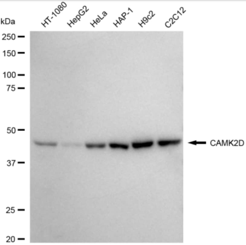 CaM Kinase II delta Antibody (24GB3390)