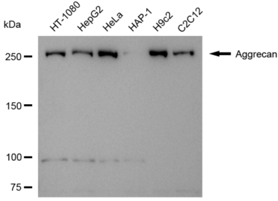 Aggrecan Antibody (24GB3415)