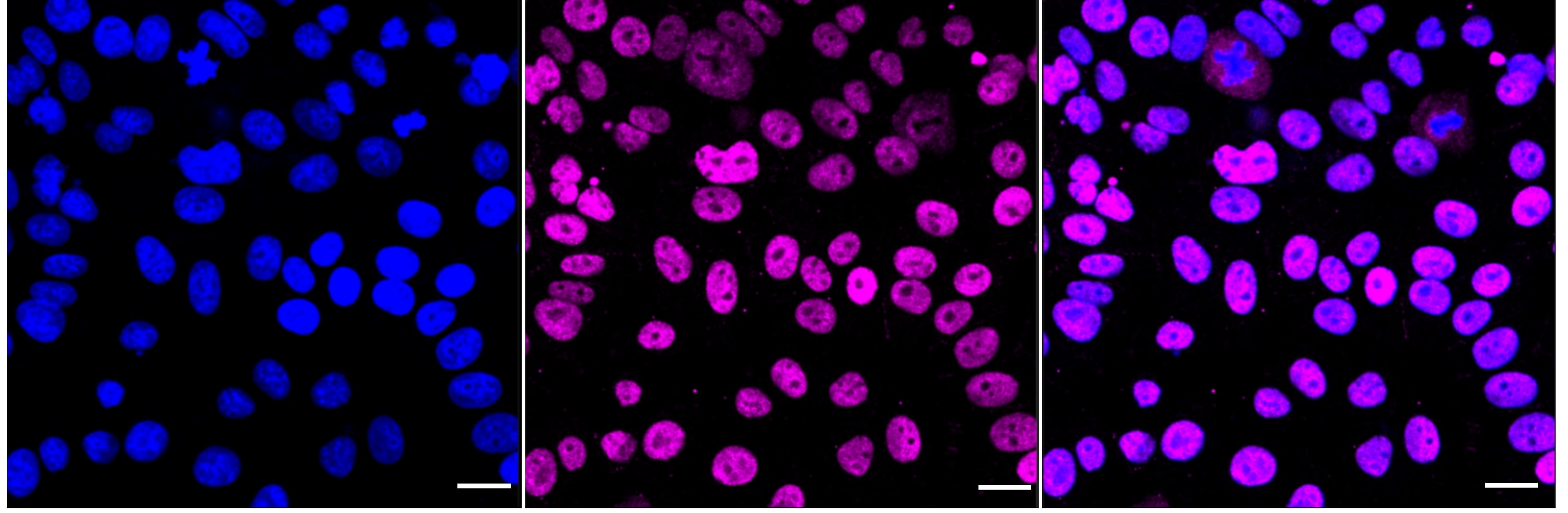 Butyrylcholinesterase/BCHE Antibody (24GB3485)