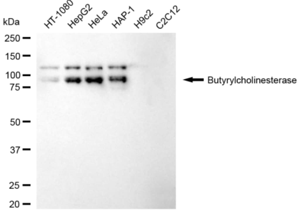 Butyrylcholinesterase/BCHE Antibody (24GB3485)